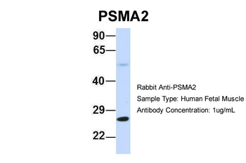 PSMA2 Rabbit Polyclonal Antibody