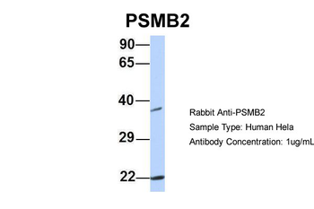 PSMB2 Rabbit Polyclonal Antibody