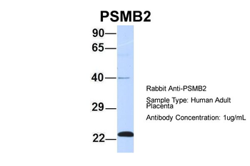 PSMB2 Rabbit Polyclonal Antibody