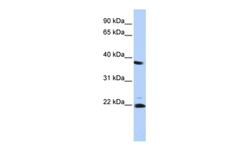 PSMB2 Rabbit Polyclonal Antibody