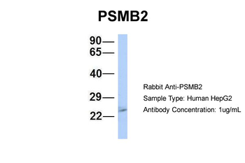 PSMB2 Rabbit Polyclonal Antibody