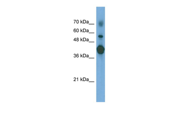 PTX3 Rabbit Polyclonal Antibody