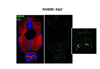 RAB5B Rabbit Polyclonal Antibody