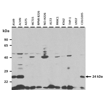 RAB5B Rabbit Polyclonal Antibody