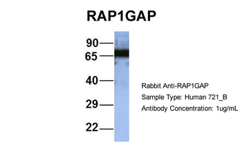 RAP1GAP Rabbit Polyclonal Antibody