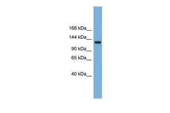 RASGRF1 Rabbit Polyclonal Antibody