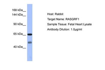 RASGRF1 Rabbit Polyclonal Antibody