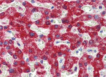 SH3BP2 Rabbit Polyclonal Antibody