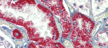 SH3BP2 Rabbit Polyclonal Antibody