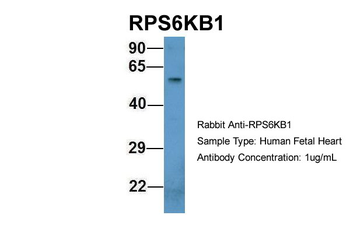 RPS6KB1 Rabbit Polyclonal Antibody