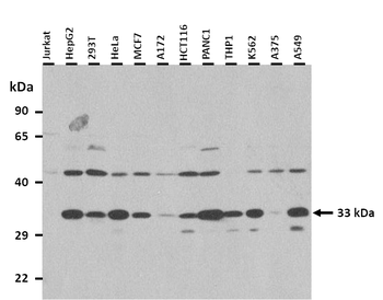 RRAD Rabbit Polyclonal Antibody