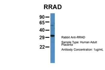 RRAD Rabbit Polyclonal Antibody