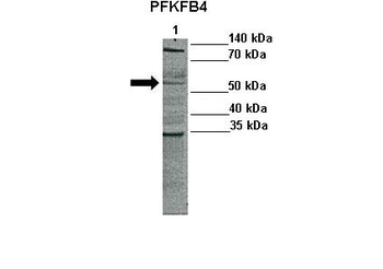 PFKFB4 Rabbit Polyclonal Antibody