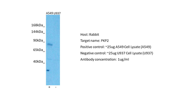 PKP2 Rabbit Polyclonal Antibody