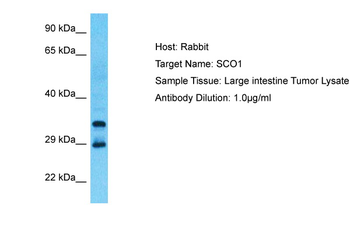 SCO1 Rabbit Polyclonal Antibody
