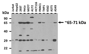 PLS3 Rabbit Polyclonal Antibody