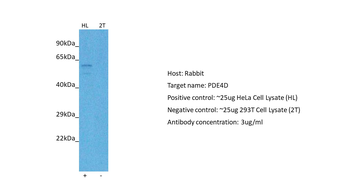 PDE4D Rabbit Polyclonal Antibody