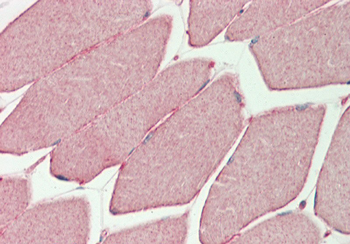 Phkg1 Rabbit Polyclonal Antibody