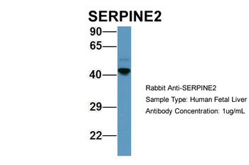 SERPINE2 Rabbit Polyclonal Antibody