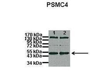 PSMC4 Rabbit Polyclonal Antibody