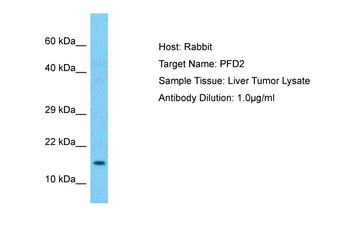 PFDN2 Rabbit Polyclonal Antibody
