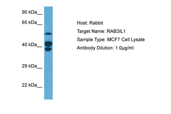 RAB3IL1 Rabbit Polyclonal Antibody