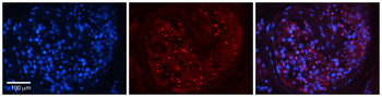RAGE Rabbit Polyclonal Antibody
