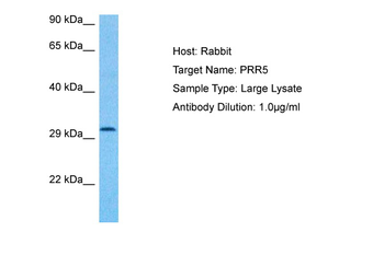 PRR5 Rabbit Polyclonal Antibody