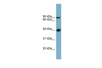 PNPLA8 Rabbit Polyclonal Antibody
