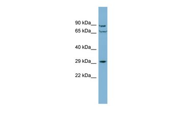 CUTC Rabbit Polyclonal Antibody