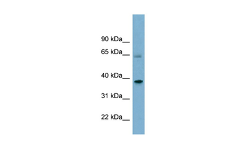 SNX7 Rabbit Polyclonal Antibody