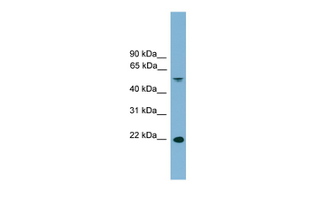 HDGFL3 Rabbit Polyclonal Antibody
