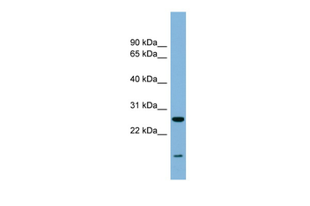 TRAPPC4 Rabbit Polyclonal Antibody