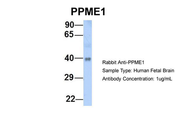 PPME1 Rabbit Polyclonal Antibody