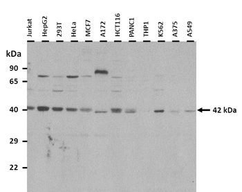 PPME1 Rabbit Polyclonal Antibody
