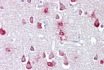 PPME1 Rabbit Polyclonal Antibody