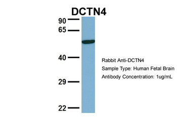 DCTN4 Rabbit Polyclonal Antibody