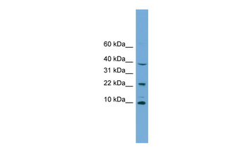 CHCHD8 Rabbit Polyclonal Antibody