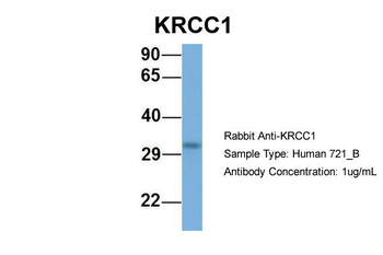 KRCC1 Rabbit Polyclonal Antibody