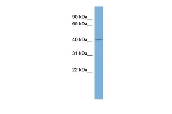 TRIM44 Rabbit Polyclonal Antibody