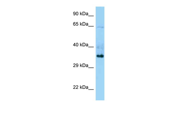 Trim44 Rabbit Polyclonal Antibody