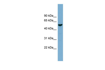FAM83E Rabbit Polyclonal Antibody