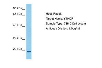 YTHDF1 Rabbit Polyclonal Antibody