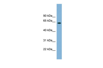 SLFN12 Rabbit Polyclonal Antibody