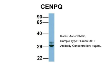 CENPQ Rabbit Polyclonal Antibody