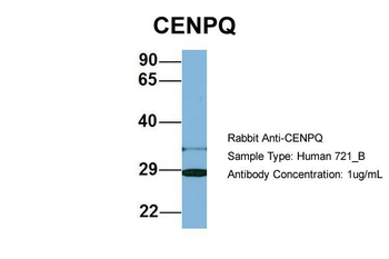CENPQ Rabbit Polyclonal Antibody