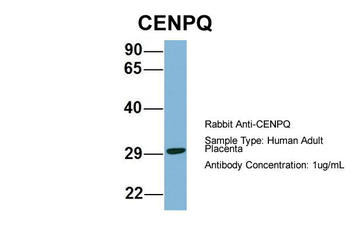 CENPQ Rabbit Polyclonal Antibody