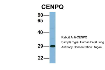 CENPQ Rabbit Polyclonal Antibody