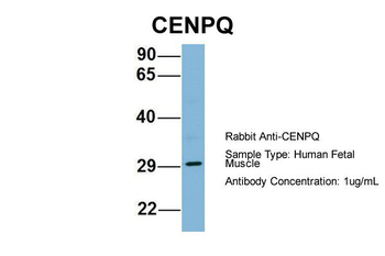 CENPQ Rabbit Polyclonal Antibody