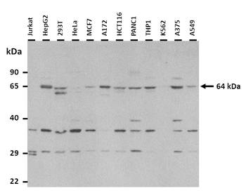 TBCCD1 Rabbit Polyclonal Antibody